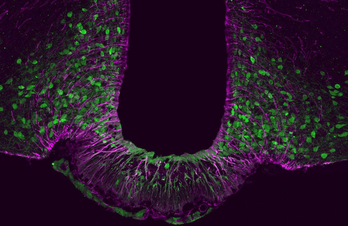La proteína Tbx3 (en verde) desempeña un papel crucial para la función y el mantenimiento de las neuronas de saciedad en el cerebro. Imagen: Helmholtz Zentrum München.