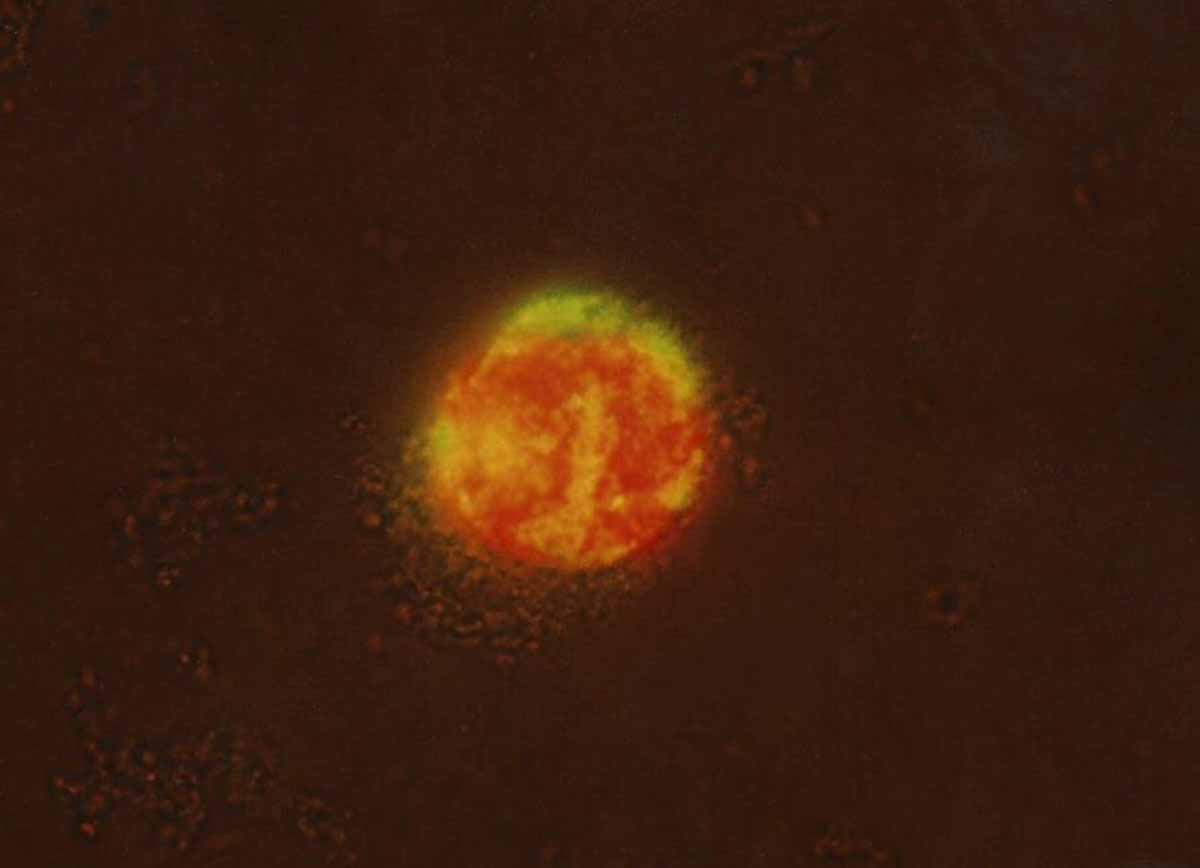 Microorganismo de la cepa TmmRV cargado de uranio. Foto: Baselga-Cervera et al.