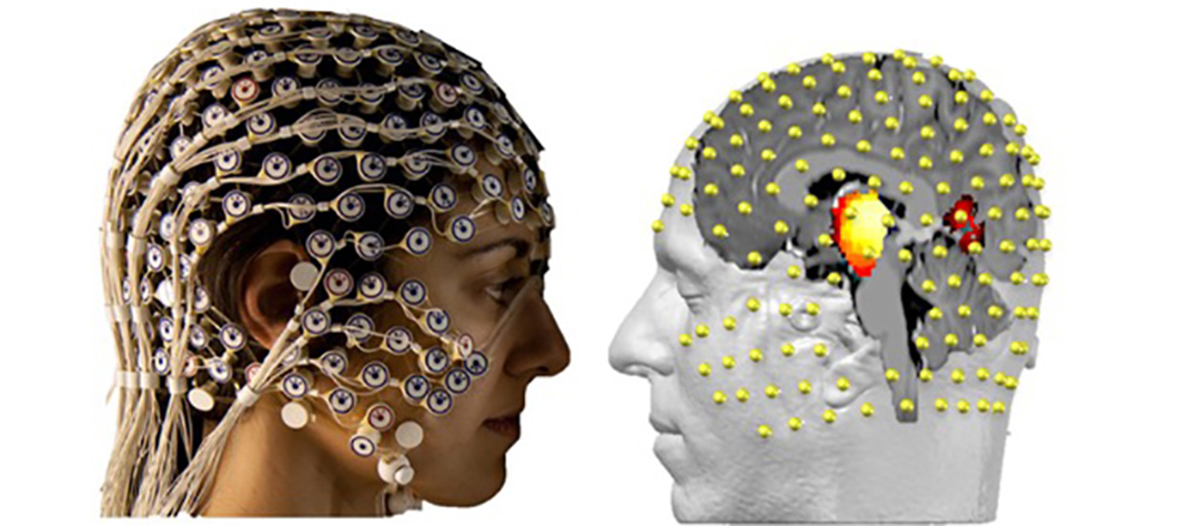 El electroencefalograma registra de manera no invasiva la actividad eléctrica del cerebro a través de 256 electrodos colocados en el cuero cabelludo. Con la ayuda de algoritmos matemáticos combinados con imágenes anatómicas, se puede ver lo que está sucediendo en las profundidades de nuestro cerebro, sin tener que entrar directamente. © UNIGE