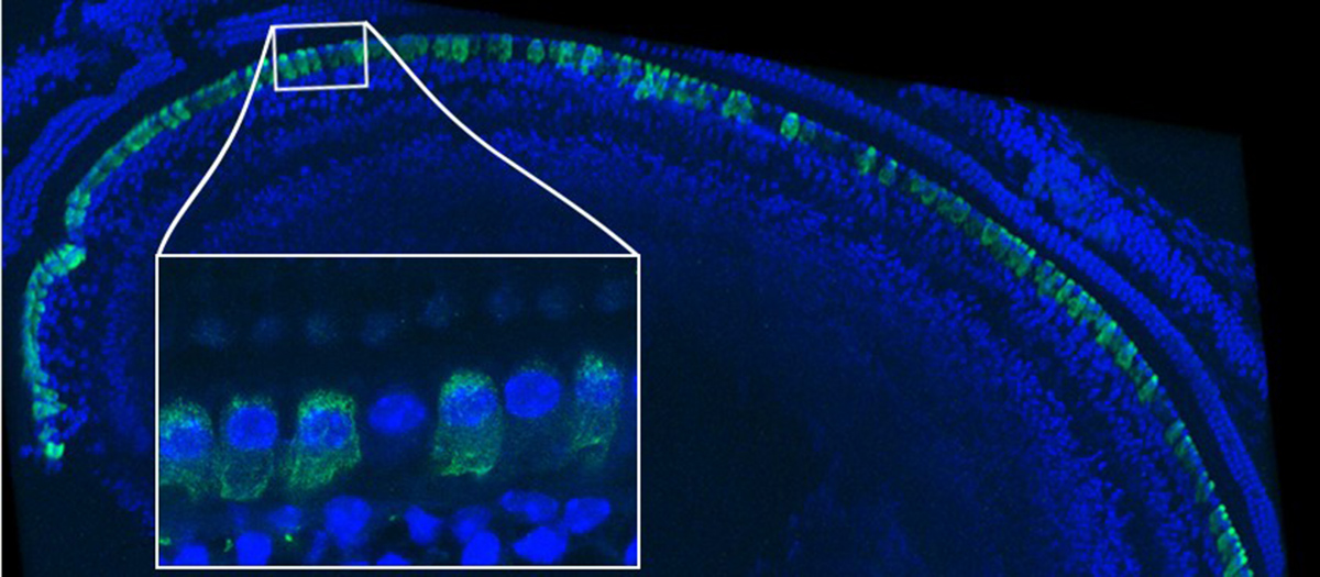 Imagen de inmunofluorescencia del epitelio sensorial de una cóclea (parte del oído interno) de ratón, tratada con terapia genética © Institut Pasteur