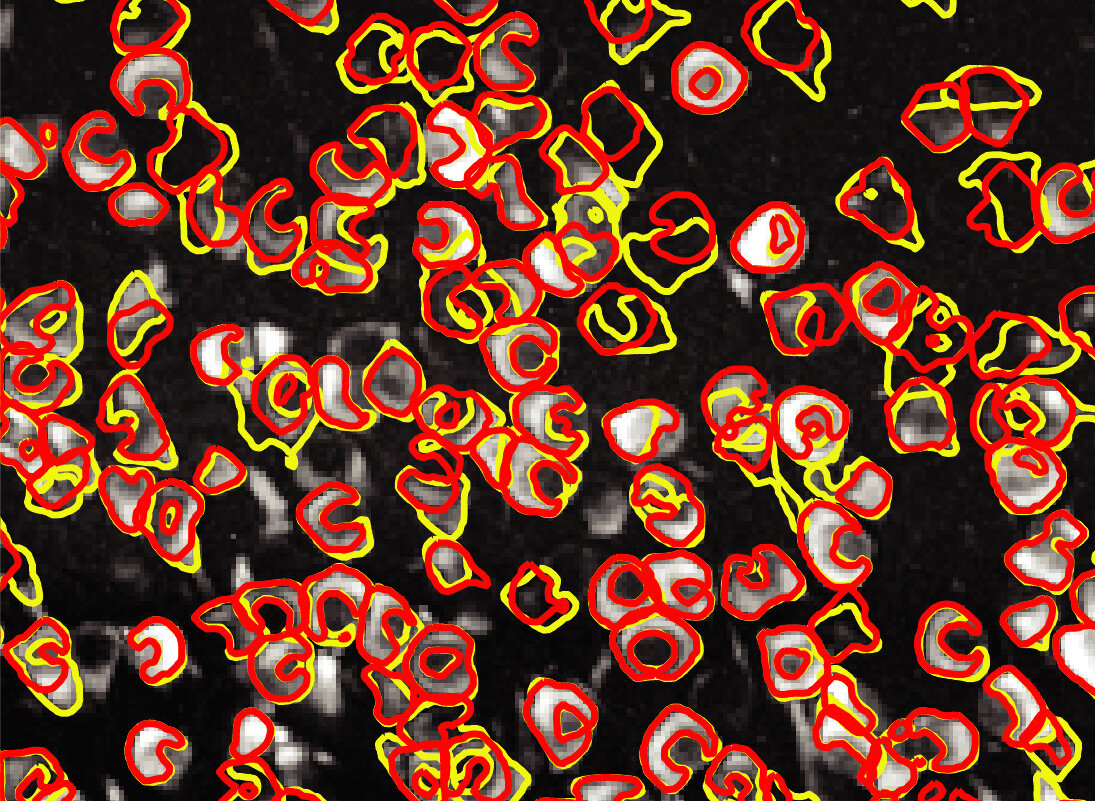 Imagen de las neuronas (blancas) tomadas mediante técnicas de calcio de imágenes. Un programa informático puede diferenciarlas automáticamente entre neuronas individuales (contornos amarillos) con casi la misma precisión que un humano (contornos rojos). Foto: Giovannucci et al./ eLife 2019