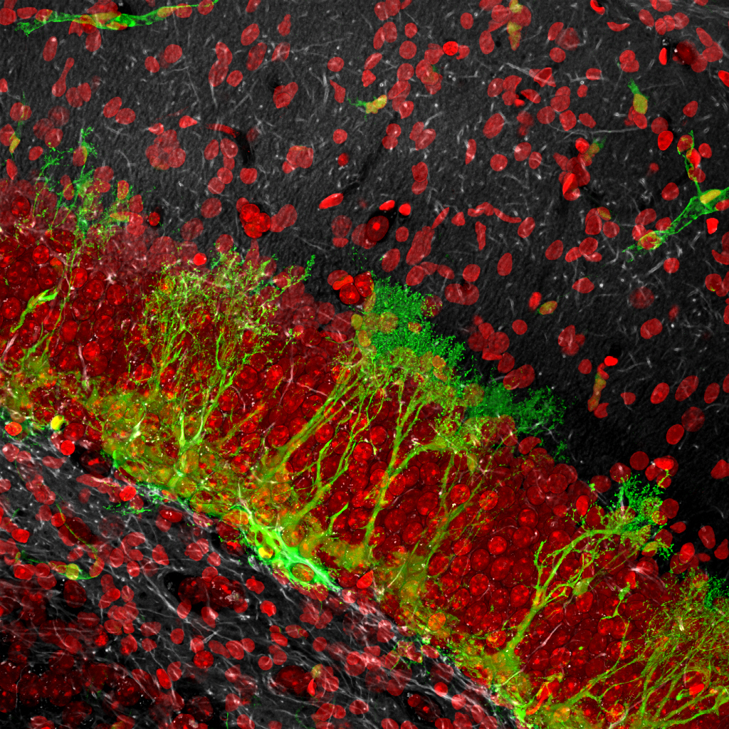 Células madre (en color verde) en la región granular de la circunvolución dentada del hipocampo (el núcleo de la neurona dentada es rojo). La foto ha recibido un premio en BioArt y se presenta en Scott Gilbert "Developmental Biology". Imagen cortesía de Grigori Enikolopov, uno de los autores de esta investigación. (MIPT)