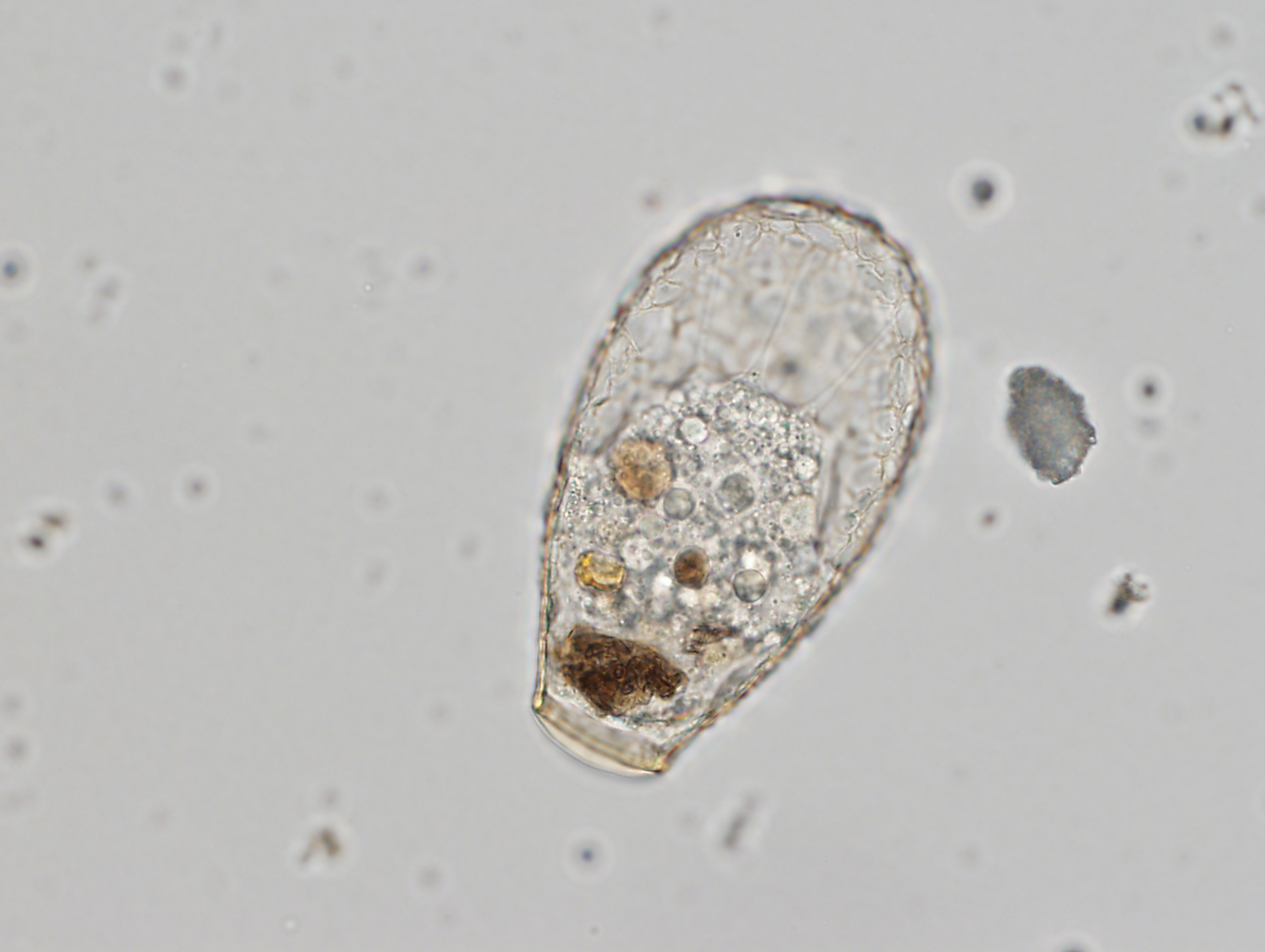 Nebela sp., un protista común en suelos forestales. Se alimenta de otros eucariotas, hongos y animales microscópicos como gusanos nematodos. Foto: Quentin Blandenier.