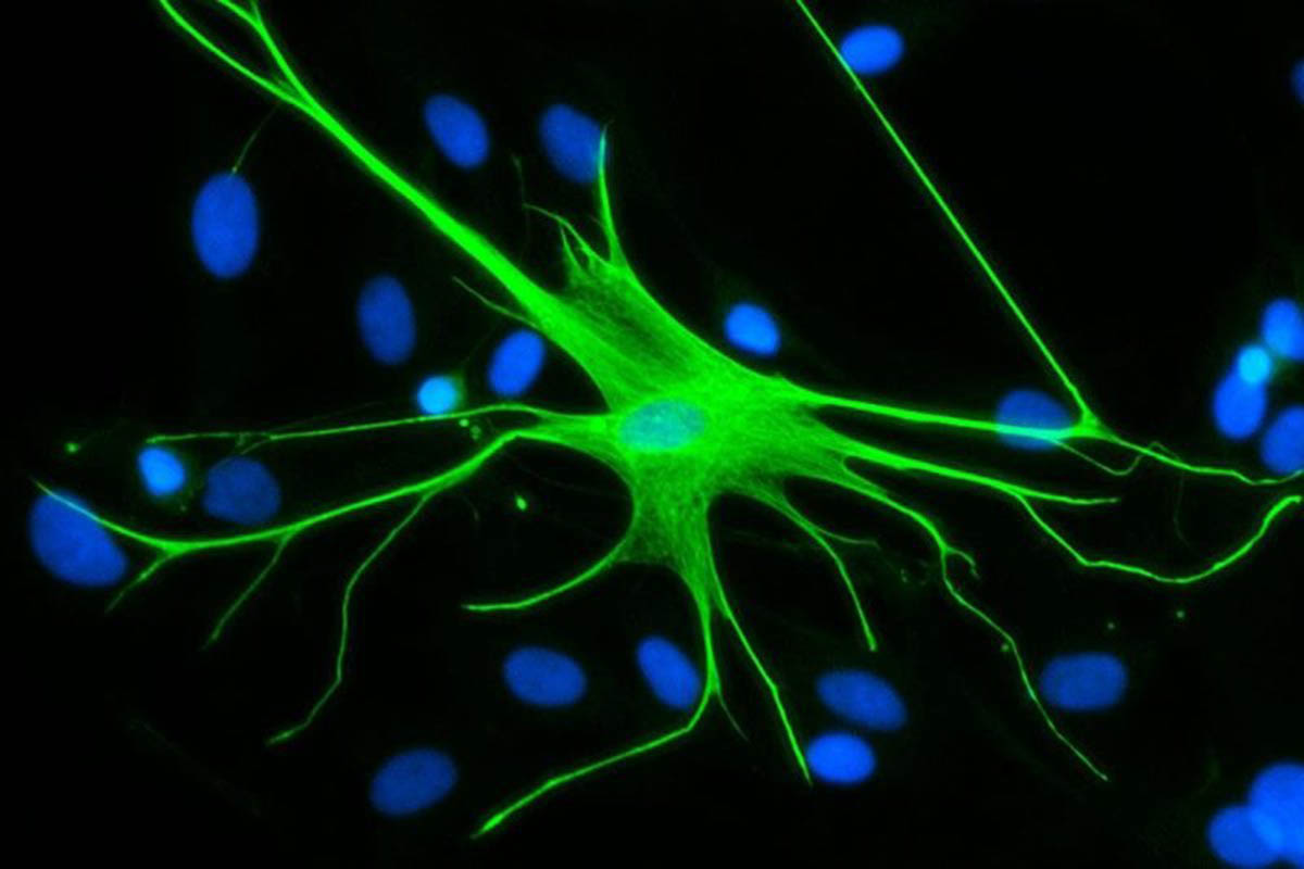 Los astrocitos humanos son importantes para la señalización cerebral. Los investigadores están adquiriendo nuevos conocimientos sobre su función al estudiar su equivalente en el gusano. (Foto: Universidad Rockefeller).