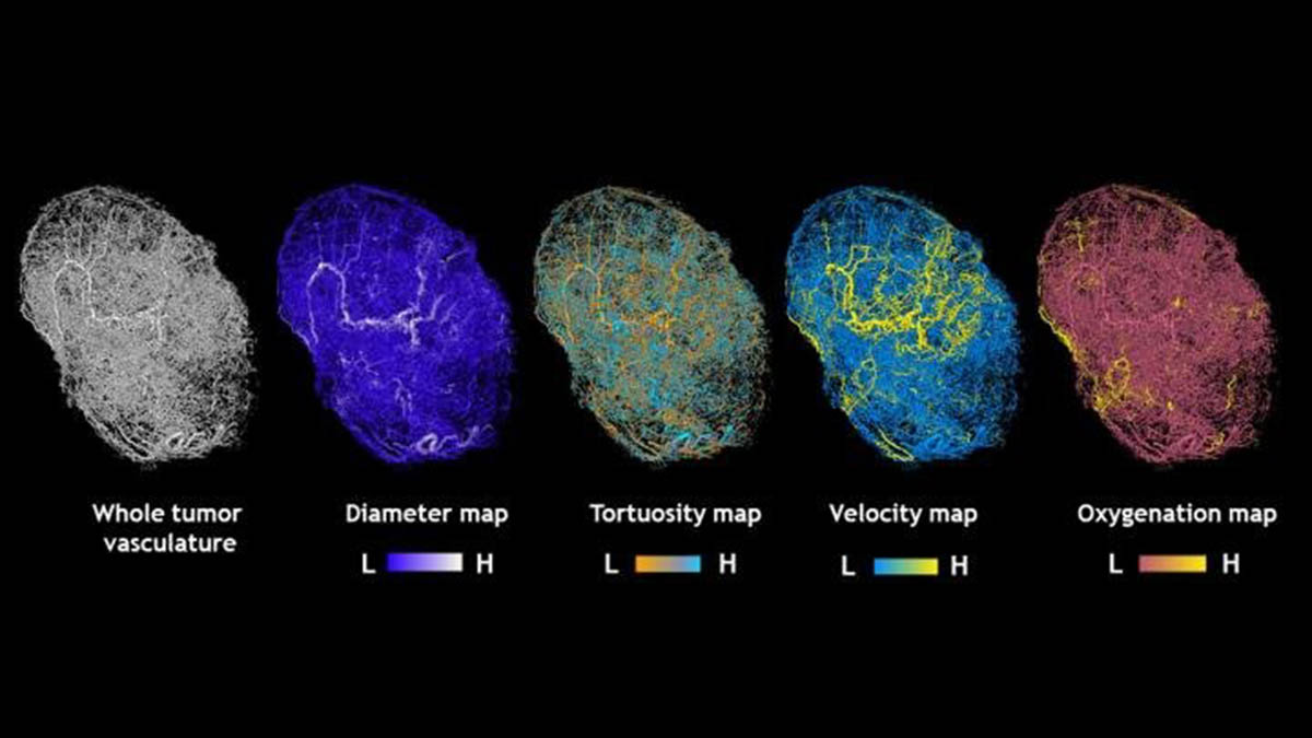 Mapas de tumores desarrollados en ratones. Foto: Arvind Pathak. Johns Hopkins Medicine.