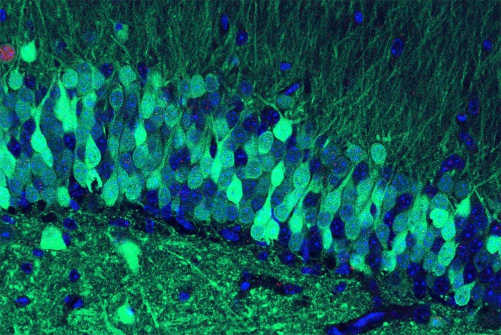 Así es como se ve un mal recuerdo en el cerebro de un ratón. Las celdas que se iluminan en verde indican que se están activando para almacenar una memoria de miedo. Foto: Steve Ramírez, Universidad de Boston.