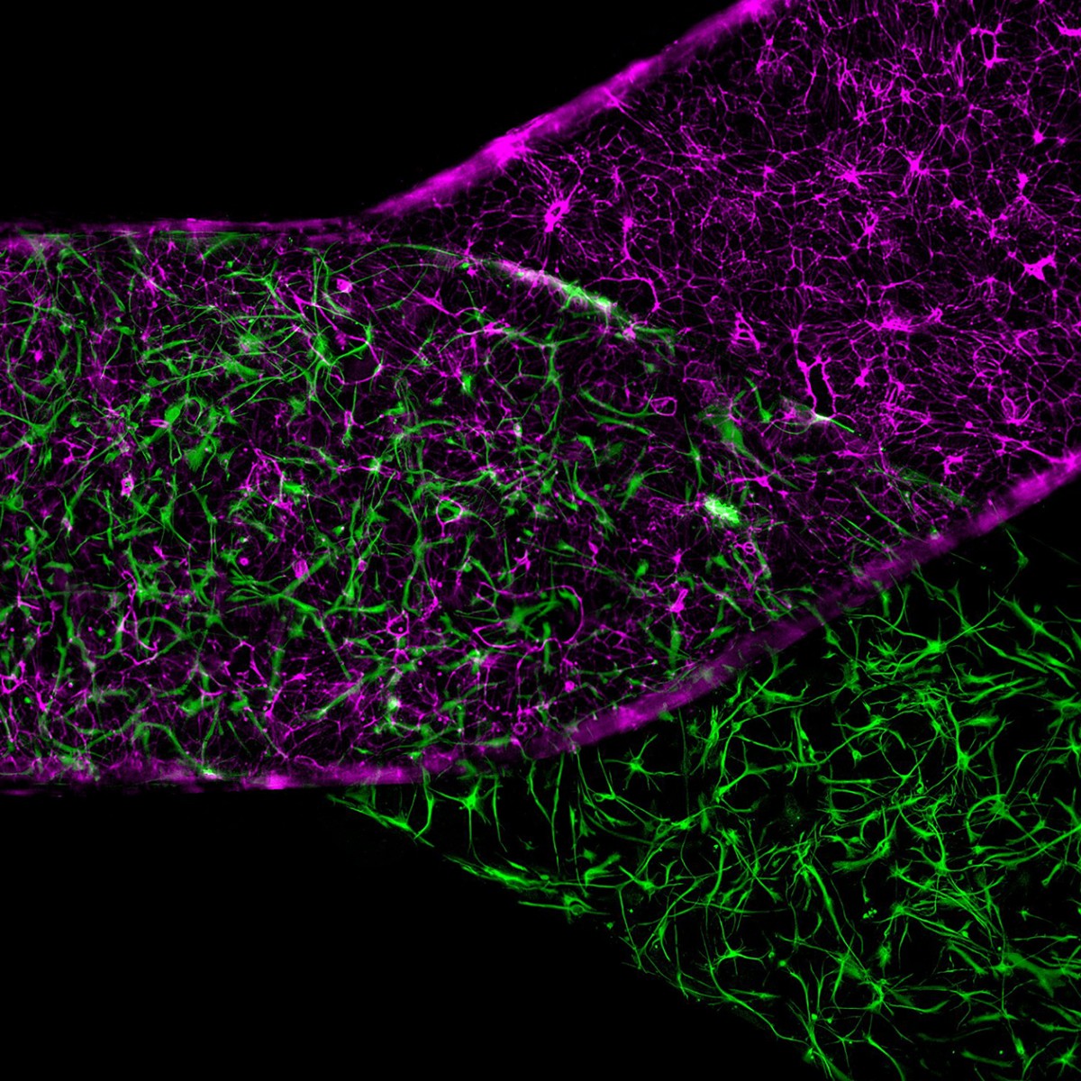 La imagen aumentada muestra una barrera hematoencefálica, con células macrovasculares endoteliales cerebrales (en magenta) en la sangre, y células de apoyo conocidas como astrocitos (en verde), en el tejido cerebral. Foto de Cedars-Sinai / Cell Stem Cell.