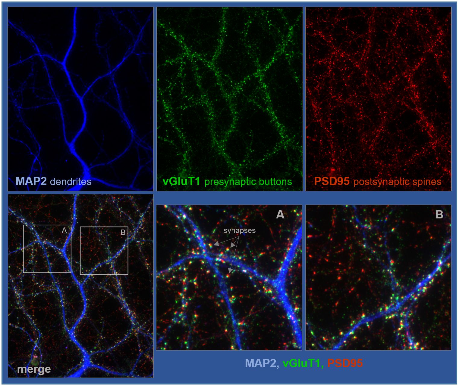 Detalle de neuronas de hipocampo crecidas durante 18 días, fijadas y procesadas para analizar sinapsis excitadoras. / UAM