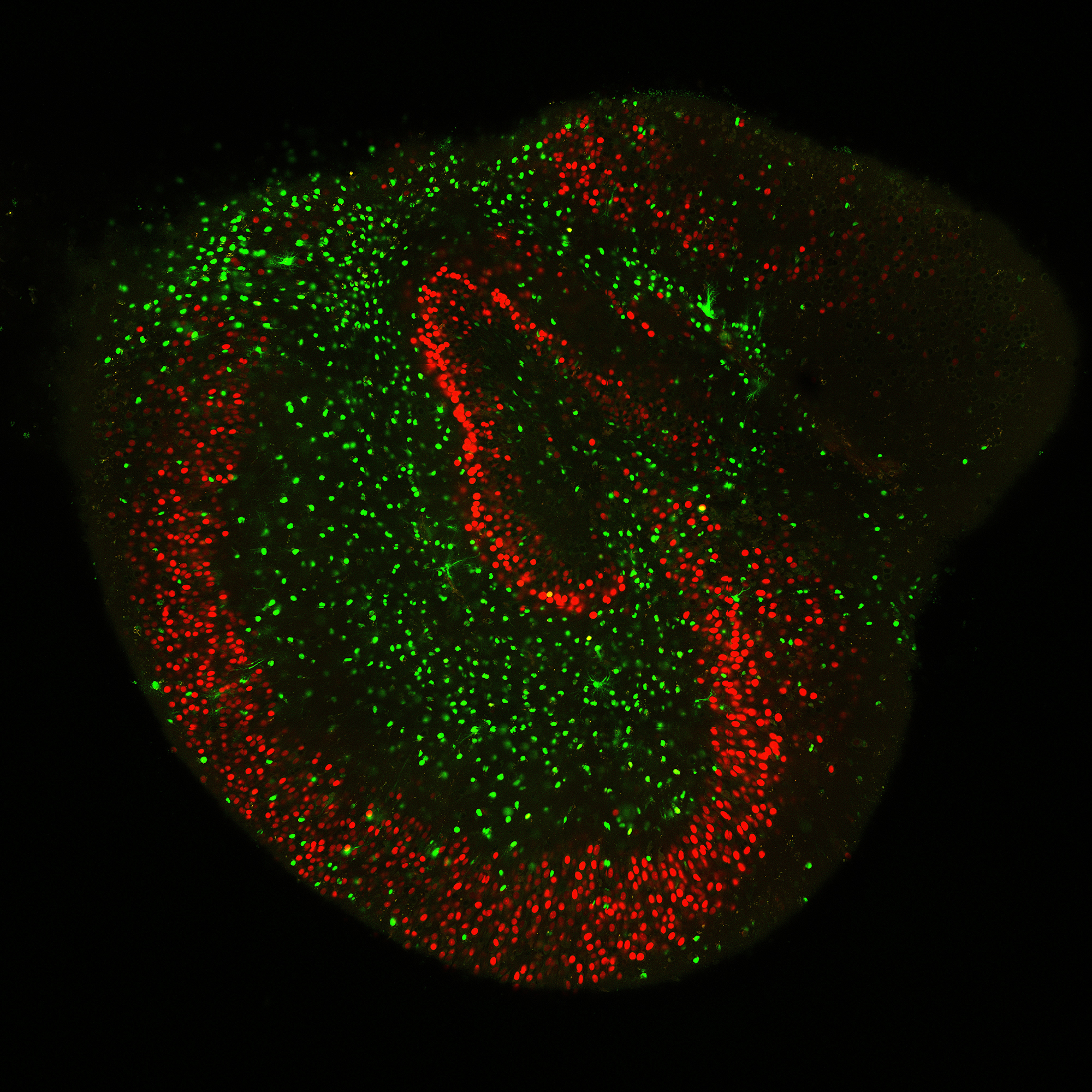 Imagen de fluorescencia de una rodaja cultivada de hipocampo de rata donde se muestran los somas de las neuronas (en rojo) y de los astrocitos (en verde).