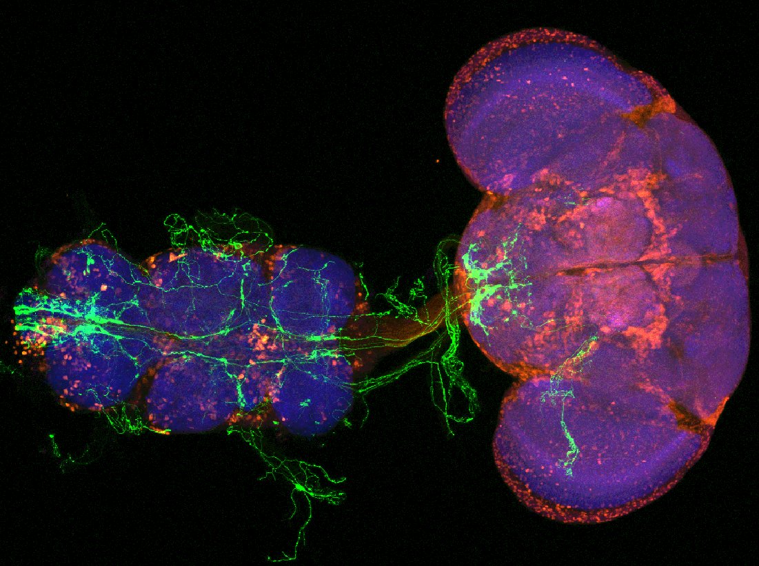 Cerebro y cordón nervioso ventral (similar a la médula espinal en humanos) de una mosca no lesionada que muestra neuronas sensoriales nociceptivas (verde), teñidas con anti-GABA, un neurotransmisor inhibitorio (rojo) y marcador sináptico neuronal nc82 (azul). Universidad de Sidney.