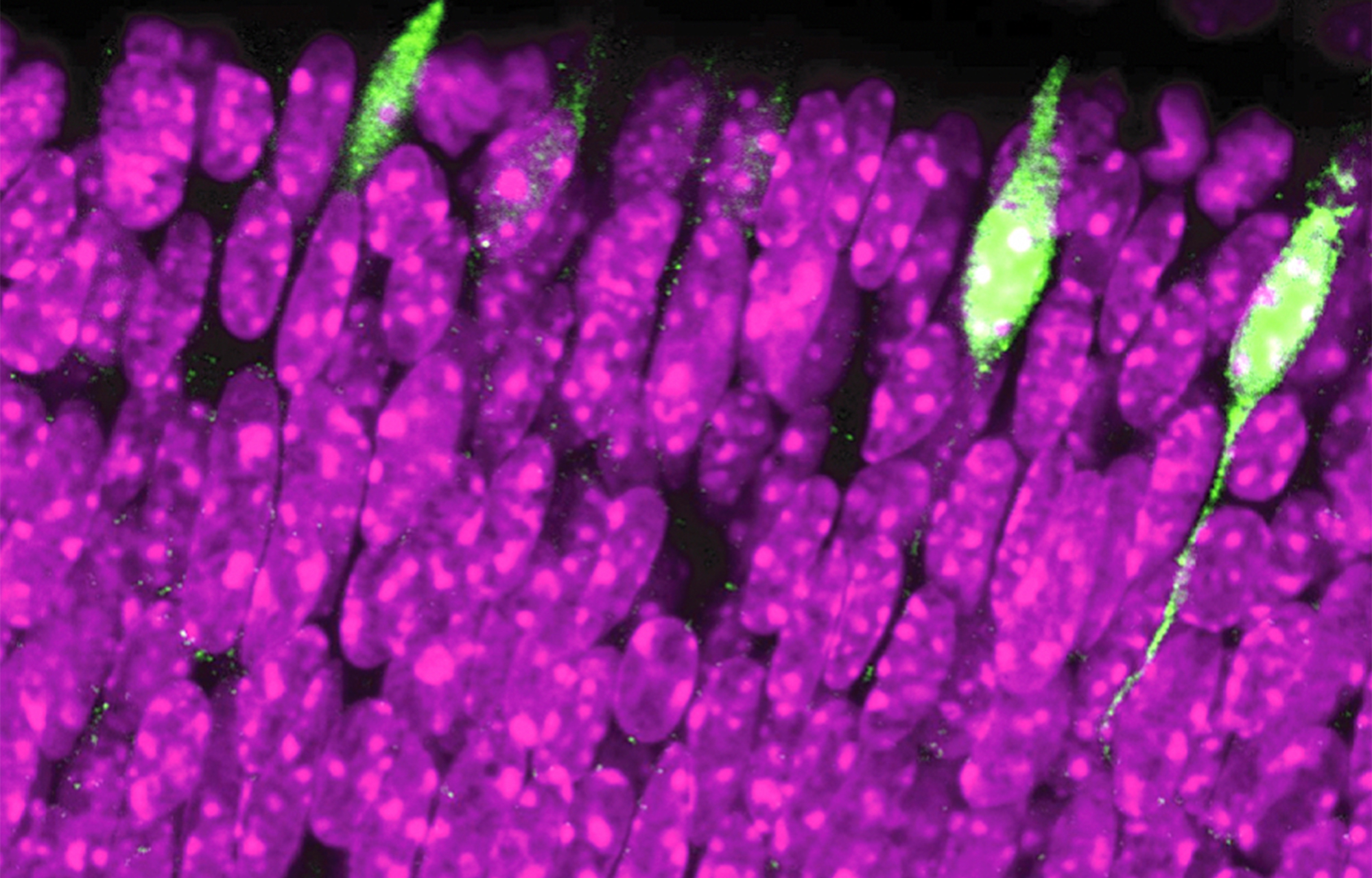 Células fotorreceptoras responsables de la visión del color. Al secuenciar una célula cada vez, los investigadores identificaron un gen (Rbp4) presente en una pequeña cantidad de células (en verde). En púrpura, fotorreceptores en los que el gen Rbp4 no está activado. © UNIGE, Pierre Fabre
