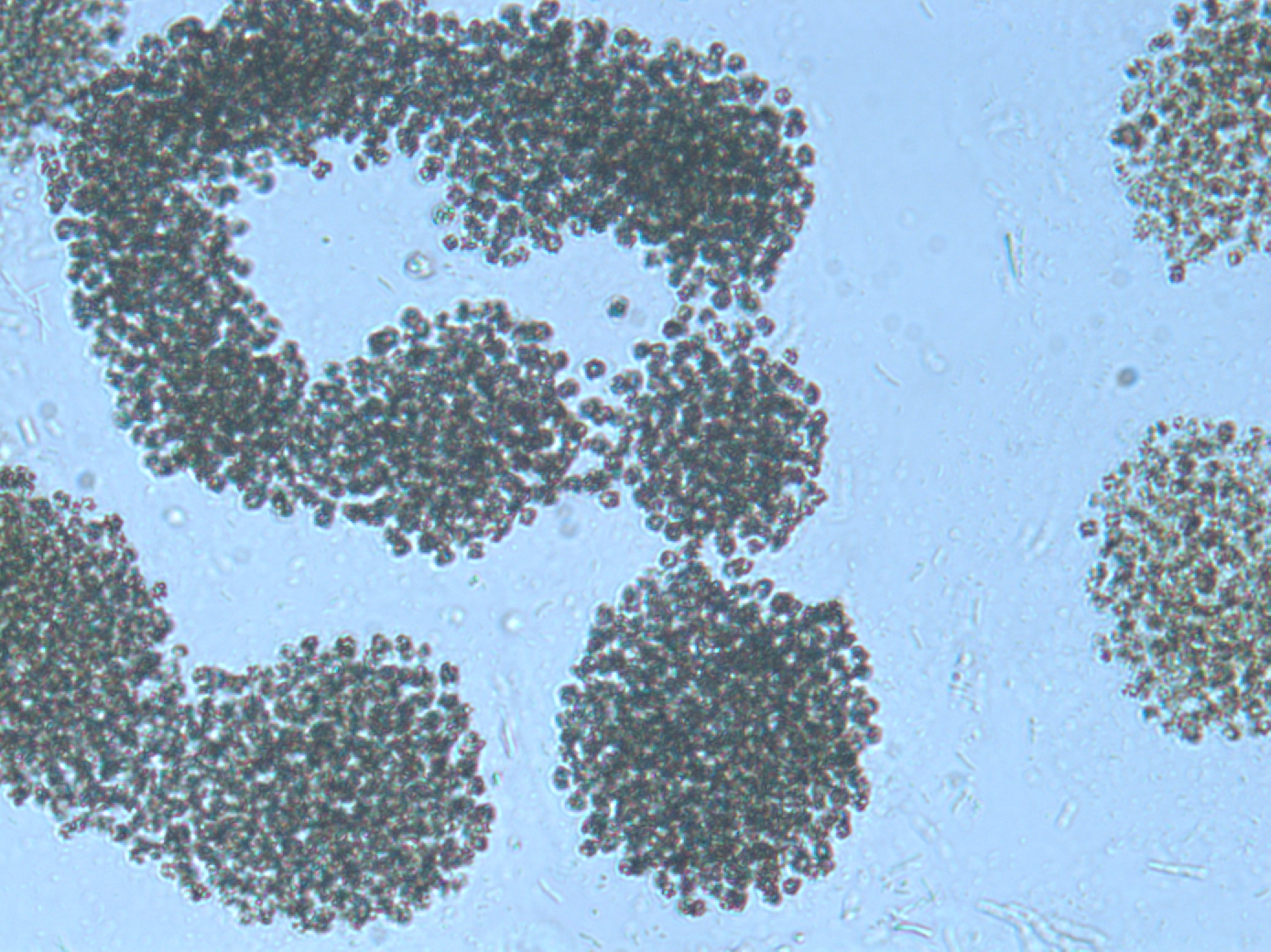 Colonias de Microcystis aeruginosa del embalse de las Conchas, Río Limia, Orense. También se observan bacterias en su mayoría coliformes fecales. Foto: E. Costas.