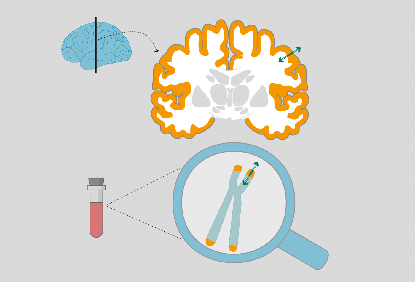 Para determinar el papel de la longitud de los telómeros en la estructura del cerebro, los científicos midieron su longitud con el ADN de los leucocitos de la sangre. Además, calcularon el grosor de la corteza cerebral con imágenes de resonancia magnética de los participantes del estudio. Compararon ambos datos y descubrieron que los cambios en la longitud de los telómeros modifica la densidad de la materia gris del cerebro en solo tres meses. © MPI CBS
