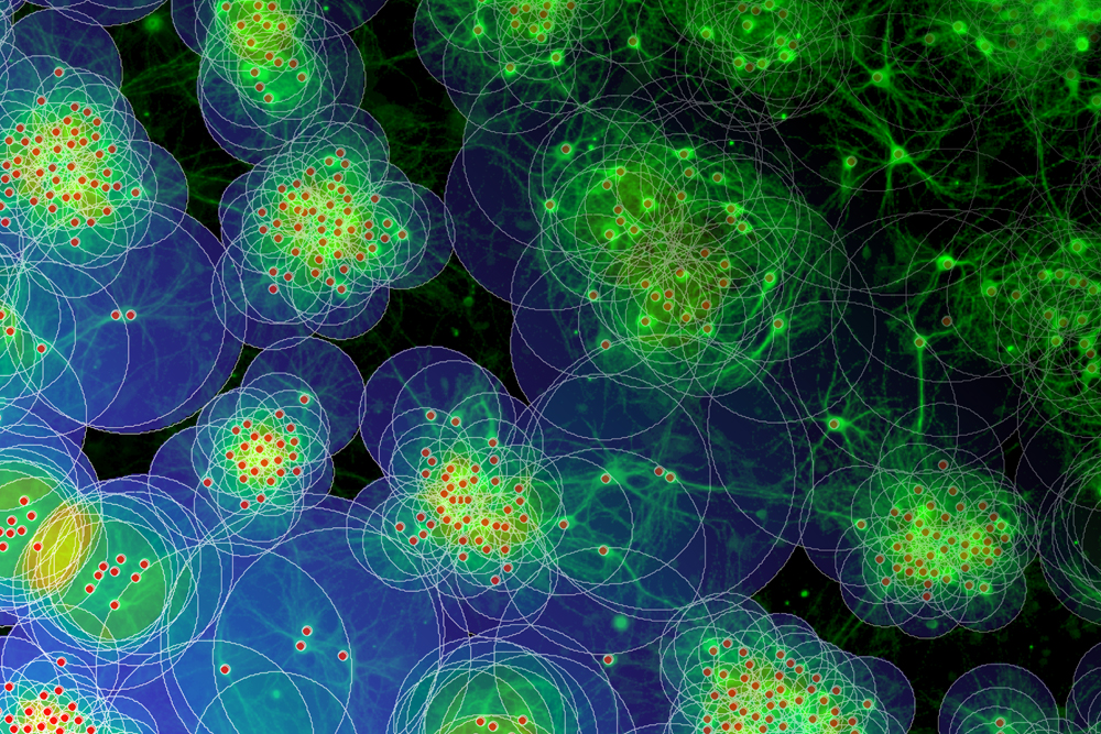 Representación gráfica de redes neuronales en el cerebro. Foto: Bernstein Centre Freiburg.