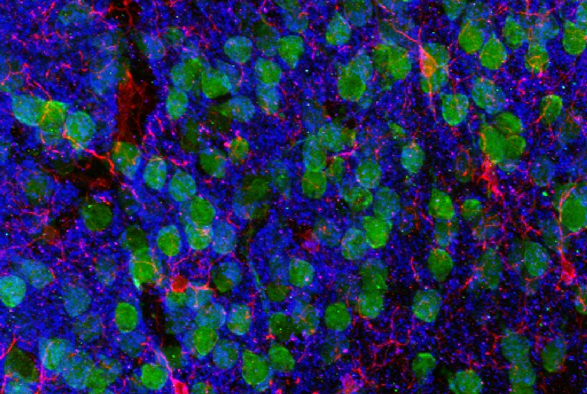 Corteza prefrontal medial que muestra neuronas corticales (verdes), microglías (rojas) y el marcador post-sináptico PSD95 (en azul). Crédito: Christopher Parkhurst y David Artis (WCM).