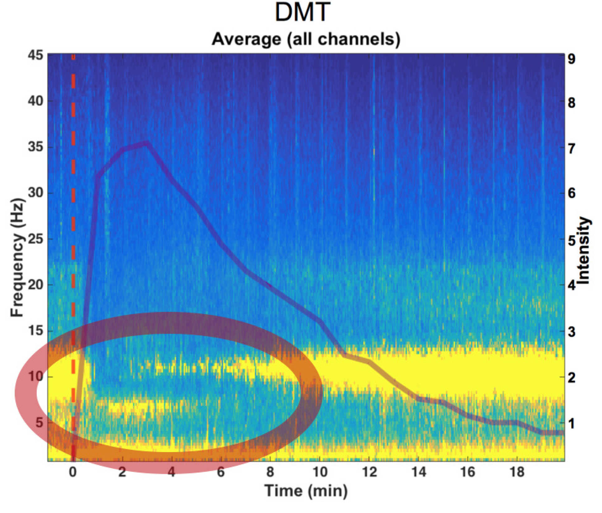 DMT altera significativamente la actividad eléctrica en el cerebro, caracterizada por un marcado descenso en las ondas alfa y un aumento en las ondas delta y theta. El círculo rojo muestra un aumento en las ondas delta y theta de baja frecuencia (Crédito: Chris Timmermann)