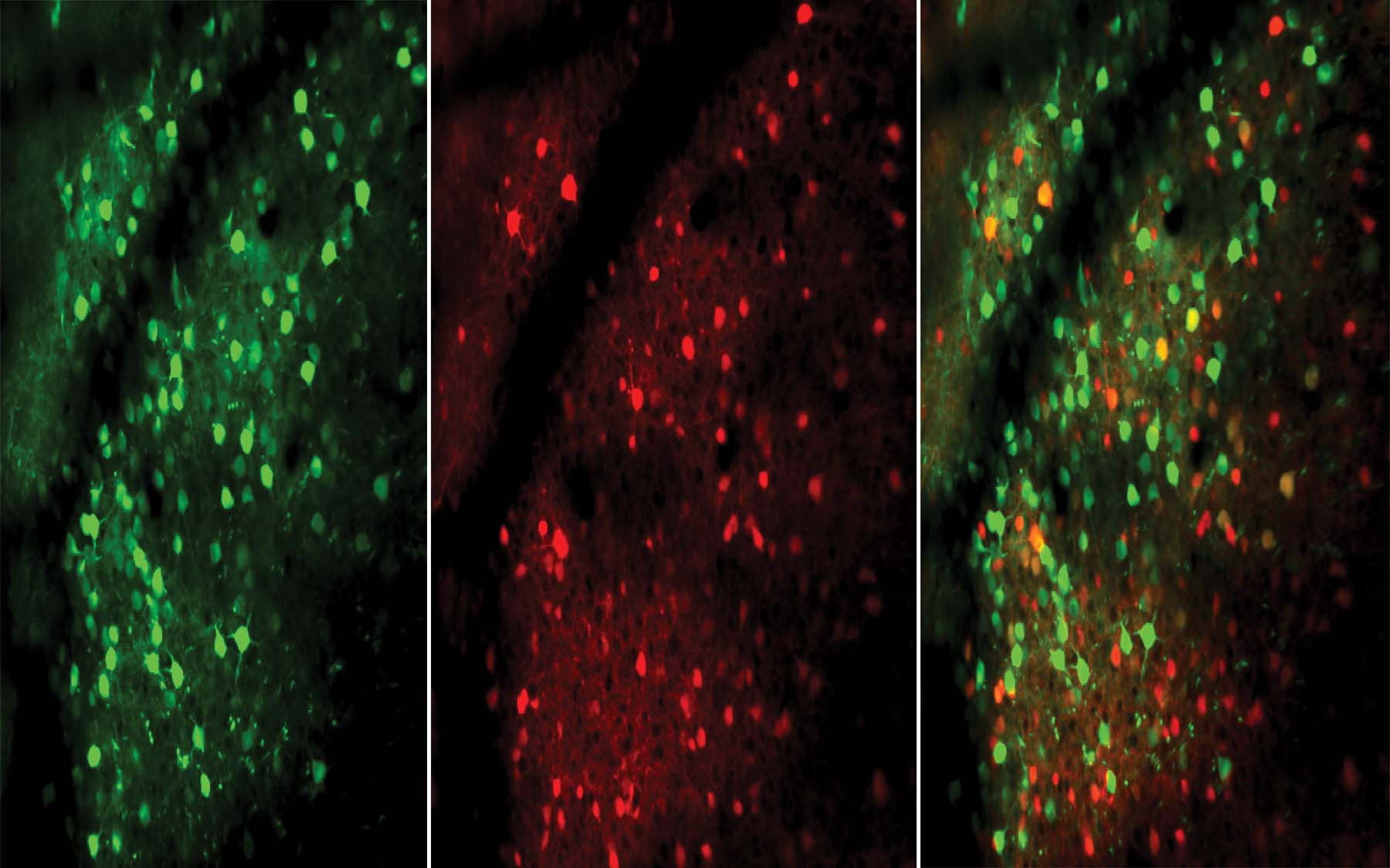 Las neuronas excitadoras (verdes) e inhibidoras (rojas), que se muestran en esta imagen microscópica del cerebro de un ratón, responden más rápido y de manera más inmediata a medida que el animal mejora en la realización de una tarea. Crédito: CSH.