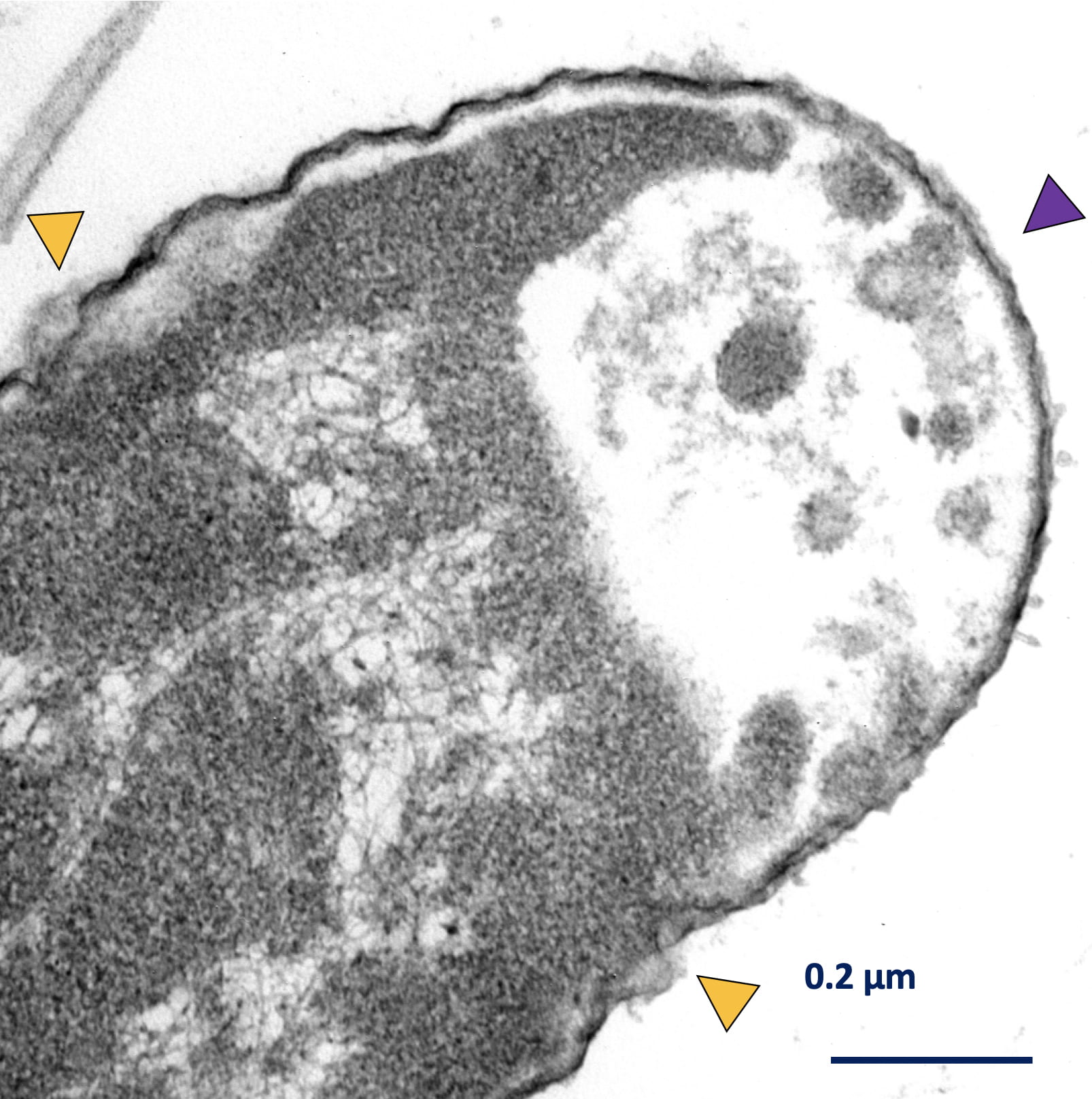 La bacteria Klebsiella pneumoniae después de la intervención combinada de máquinas moleculares y antibióticos. Las flechas amarillas muestran áreas de interrupciones de la pared celular, mientras que la flecha púrpura muestra dónde la bacteria ha perdido parte de su citoplasma. Imagen de Don Galbadage / Texas A&M.