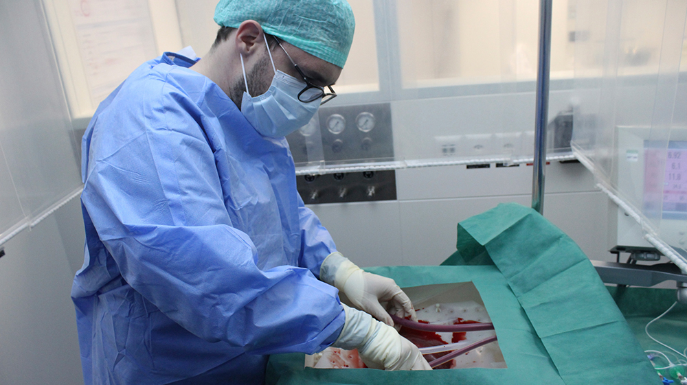 Un cirujano conecta el hígado del donante a la máquina de perfusión. (USZ) (Imagen: beamue)