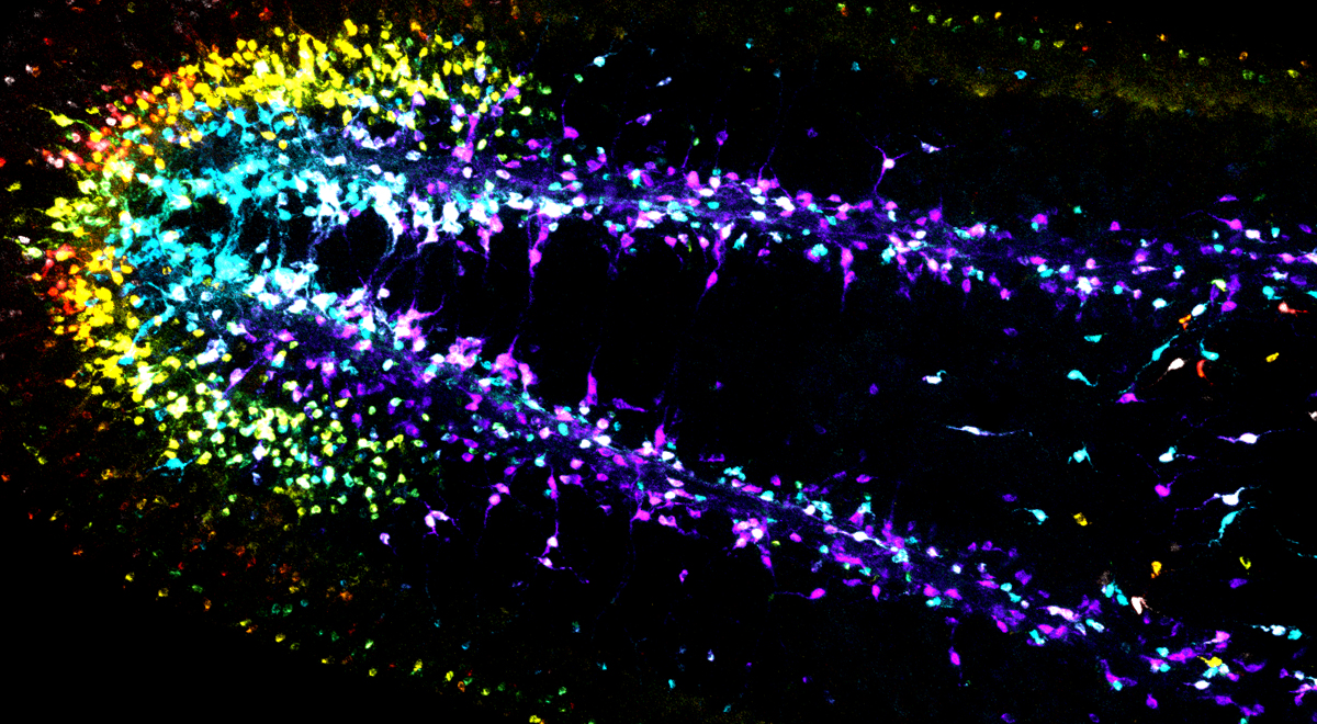 Crecimiento de las neuronas en el cerebro de un gusano. Foto: Cortesía de Wang Lab
