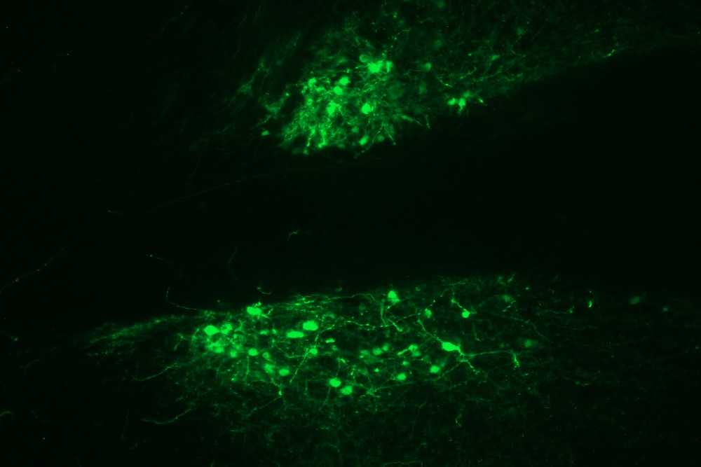 Imagen ampliada de células en la amígdala extendida. El color verde indica células que producen la proteína activadora del receptor opioide kappa. Imagen cortesía de JR Haun.(MUSC).