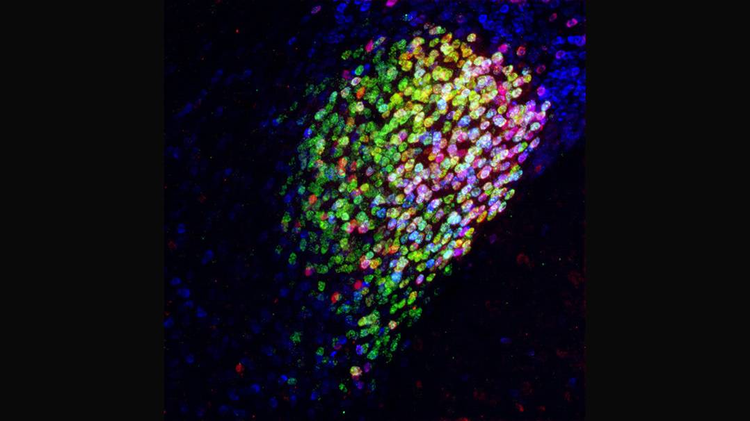 Neuronas de la amígdala central de un cerebro de ratón. Las rojas, magentas y amarillas (pero no verdes o azules) son parte de una colección de neuronas llamadas CeAga que tienen potentes capacidades de supresión del dolor. (Fan Wang Lab).