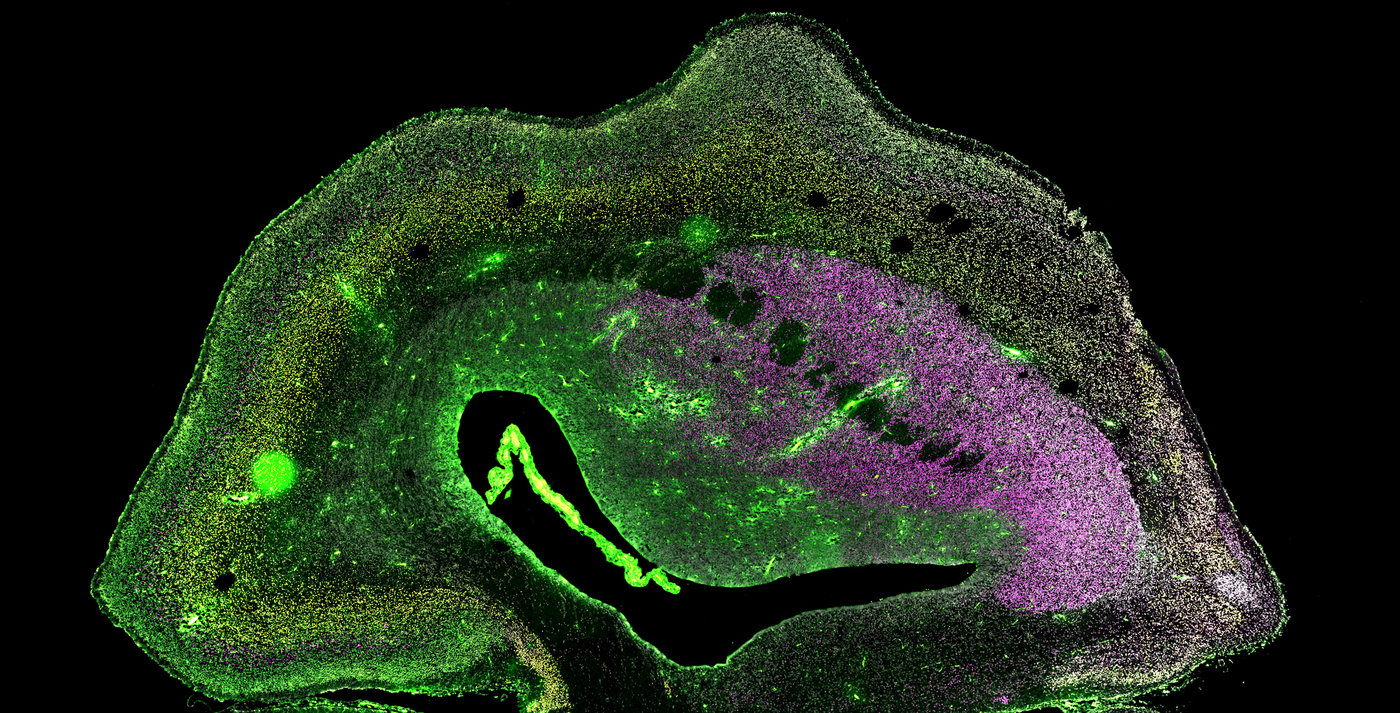 Imagen de microscopía del hemisferio cerebral de un feto de tití transgénico ARHGAP11B, de 101 días de gestación. Se visualizan diferentes poblaciones neuronales (magenta, amarillo, verde). Los núcleos celulares se visualizan en blanco. © Heide y col. / MPI-CBG.