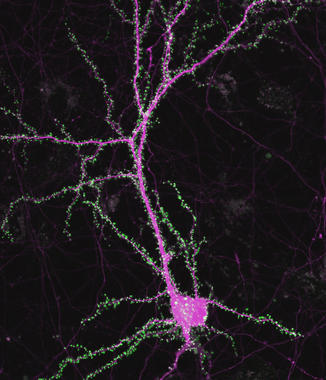 Las proteínas SRPX2 y FOXP2 son claves en el desarrollo neuronal. Imagen: Yoichi Araki. Fuente: Universidad Johns Hopkins.