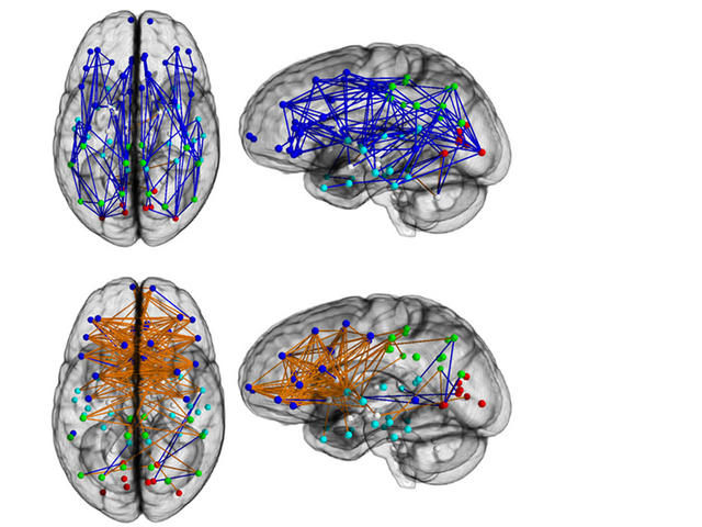 En la parte superior el cerebro masculino, en la inferior el femenino. En azul, las conexiones en un mismo hemisferio, en naranja los circuitos entre hemisferios. Fuente: PNAS/SINC.