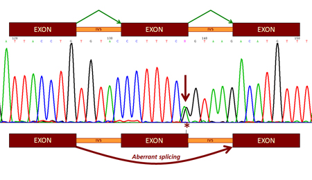 Impacto de las mutaciones sobre el 'splicing', las etapas básicas de la expresión génica. Fuente: CSIC.