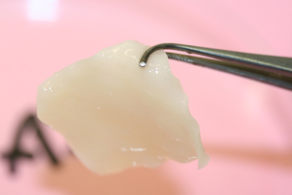 Cartílago desarrollado en laboratorio, a partir de células de cartílago del tabique nasal de los pacientes. Fuente: Universidad de Basilea.