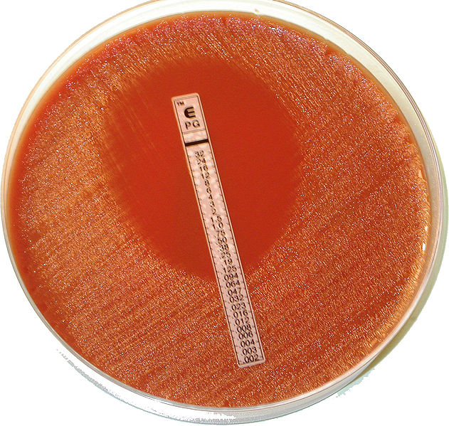 Prueba de epsilometría. Un cultivo puro de bacterias crece sobre una placa de Petri (que contiene un medio de cultivo sólido gelificado mediante agar) excepto en el punto en el que la tira de antibióticos comienza a inhibir su crecimiento. Fuente: Wikipedia.