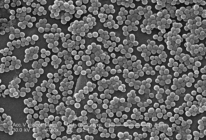Microscopio electrónico de barrido mostrando al Staphylococcus aureus resistente a meticilina. Imagen: CDC/ Janice Carr/ Deepak Mandhalapu, M.H.S. Fuente: Wikipedia.