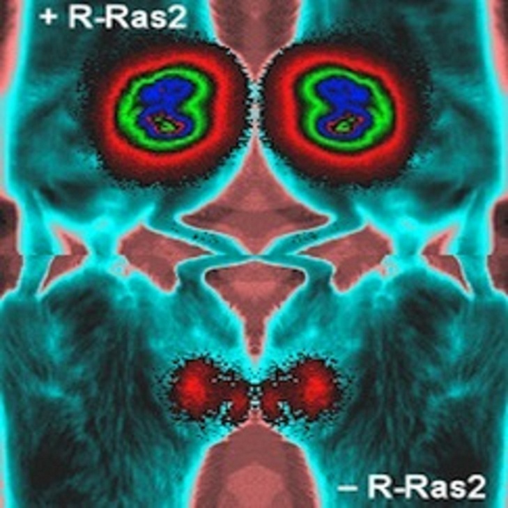 La proteína R-Ras2/TC21 está implicada en dos procesos tumorales, según los científicos. Fuente: CIC.