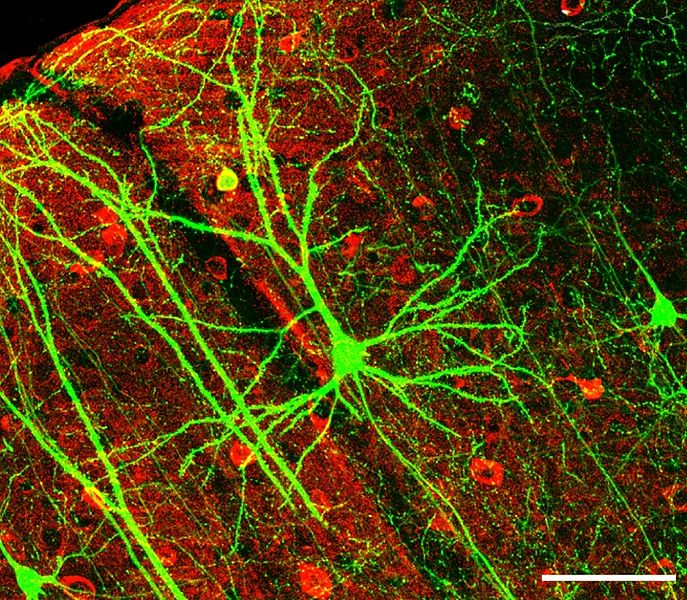 Los científicos investigan cómo mantiene el cerebro su capacidad de recordar. En la imagen, neuronas. Fuente: Wikipedia.