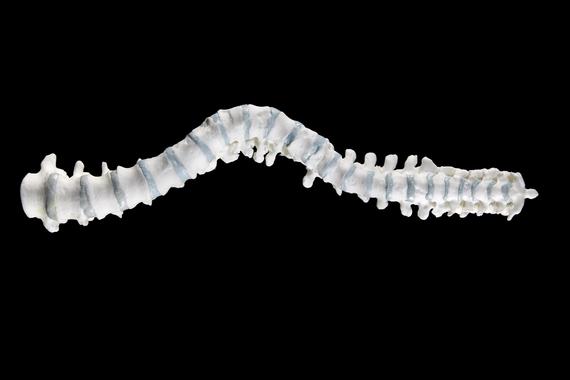 Reconstrucción en 3D de la columna vertebral de Ricardo III. Fuente: Universidad de Leicester.