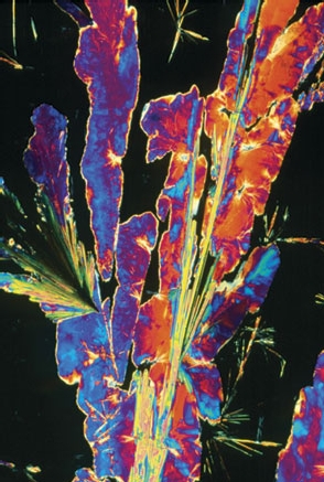 Cristales de propranolol. Sidney Moulds / Science Photo Library. The dana Foundation.