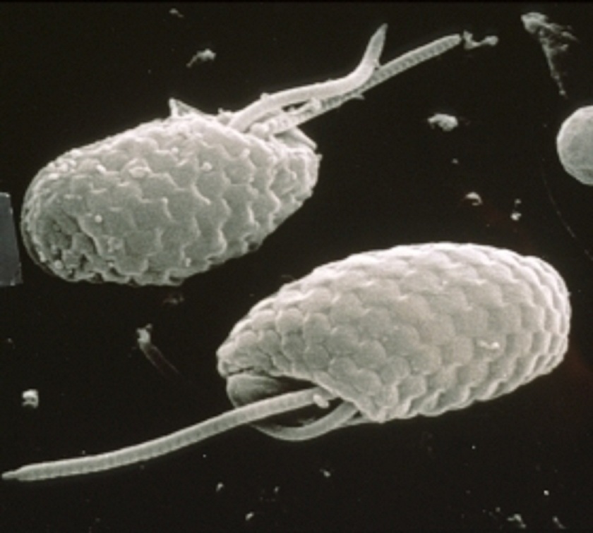 Imagen de las criptofitas obtenida por microscopio electrónico. Fuente: Csiro (agencia nacional de investigación científica de Australia).