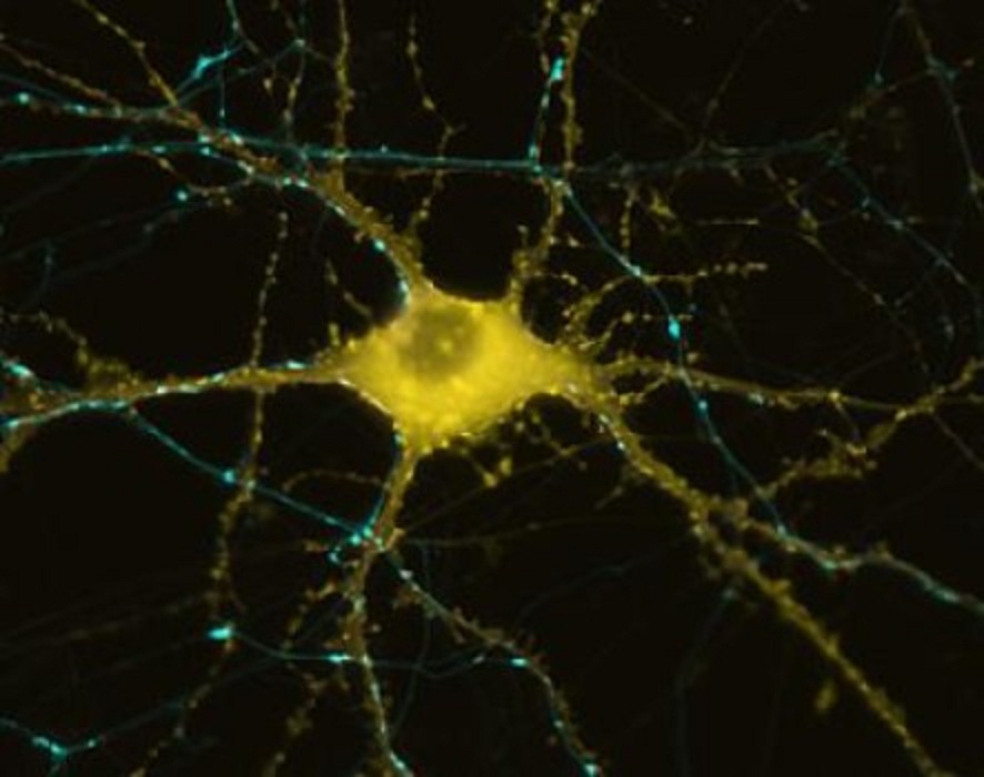 Neurona humana que muestra la formación de actina como respuesta a la estimulación.  Imagen: Michael A. Colicos. Fuente: UC San Diego.