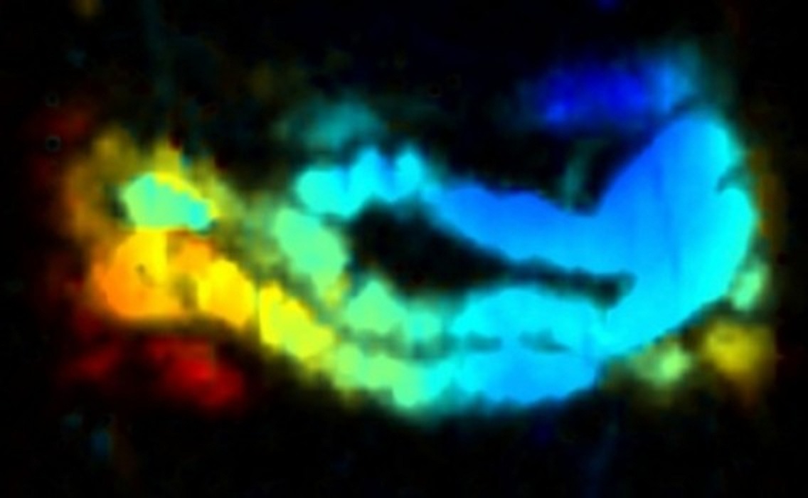 La combinación del nanozumo y de la tomografía fotoacústica ilumina el intestino de un ratón. Imagen: Jonathan Lovell. Fuente: Universidad de Búfalo.