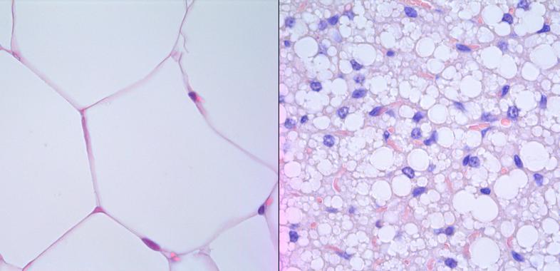 Grasa blanca procedente de un ratón sano (izquierda) y tejido adiposo transformado en marrón procedente de un ratón con cáncer, donde los adipocitos son más pequeños y los núcleos celulares más grandes (izquierda). Imagen: Michele Petruzzelli. Fuente: CNIO.