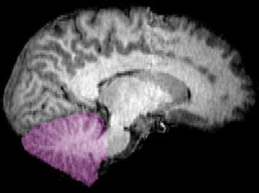 Imagen del cerebelo (en púrpura). Fuente: Wikipedia.