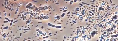 Muestra de microbiota de heces humanas. Fuente: CSIC.