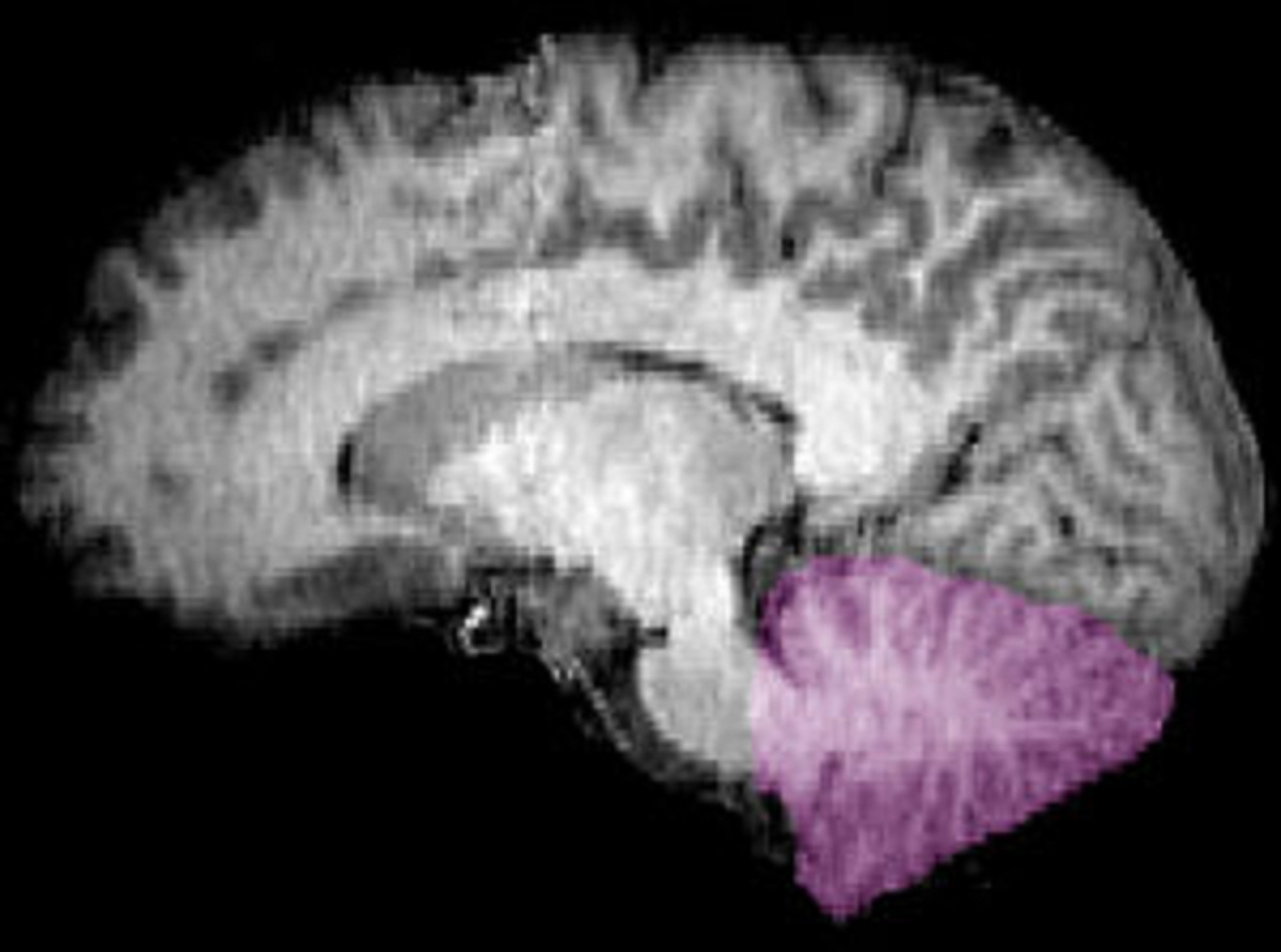 Imagen de resonancia magnética nuclear de una sección sagital de un encéfalo humano. Cerebelo en púrpura. Fuente: Wikipedia.