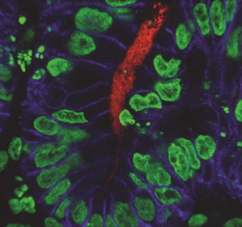Inmunofluorescencia del tejido gástrico, con la presencia de 'H. pylori' (rojo). Imagen: Kyle W. McCracken. Fuente: Centro Médico del Hospital Infantil de Cincinnati.