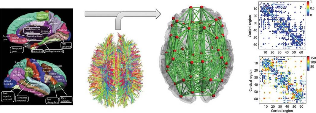 Representación de conectividades cerebrales. Fuente: UPF.