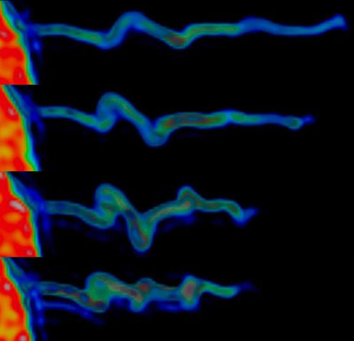 La imagen muestra cómo la actina del interior de los filopodios se contrae mintras forma una estructura con forma de espiral. Fuente: Instituto Niels Bohr.