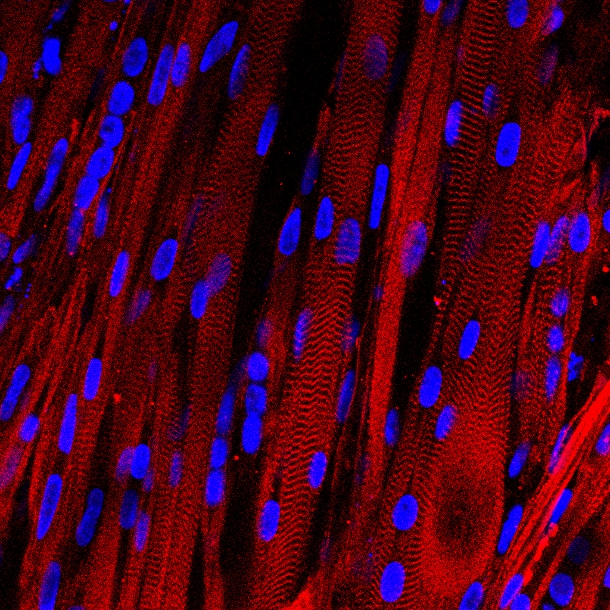 Vista microscópica de las fibras musculares humanas cultivadas en laboratorio, teñidas para mostrar los patrones que forman sus unidades musculares básicas y sus proteínas asociadas (en rojo), y que son característicos de los músculos humanos. Fuente: Universidad de Duke.