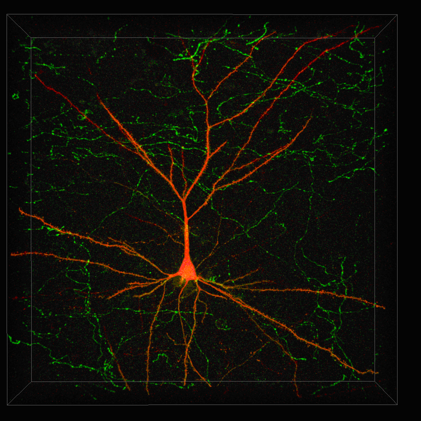 Imagen virtual de una neurona. Fuente: FIUPM.