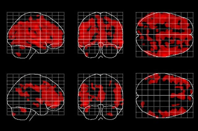 Las áreas del cerebro afectadas por el envejecimiento (en rojo) son menos extensas en las personas que meditan (las de la fila inferior). Imagen: Eileen Luders. Fuente: UCLA.